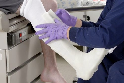 Scotchcast 3M LEKKI GIPS SYNTETYCZNY 10,1cm x 3,6m na Arena.pl