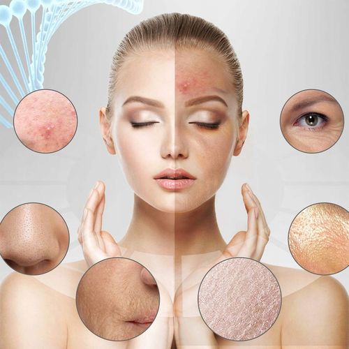 PEELING KAWITACYJNY BEZPRZEWODOWY JONOFOREZA SONOFOREZA PILING DO na Arena.pl