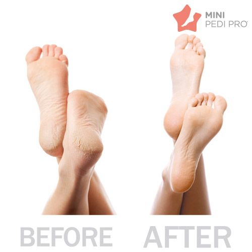 Zestaw do Pedicure MINI Pedi Pro na Arena.pl