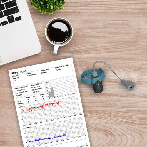 Pulsoksymetr ViATOM SleepU dla Androida i iOS z aplikacją na Arena.pl