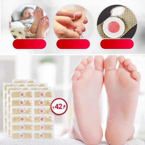 Plastry Usuwające Kurzajki na odciski Odcisków Stóp Plastry 42 Szt na Arena.pl