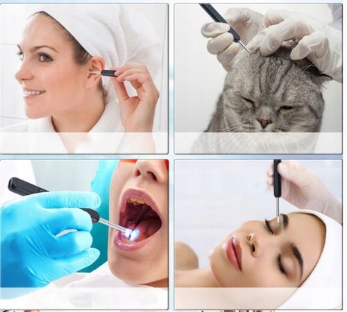 ZESTAW DO USUWANIA WOSKOWINY Z KAMERĄ 8 MEGAPIXELI HD 6 LED ENDOSKOP na Arena.pl