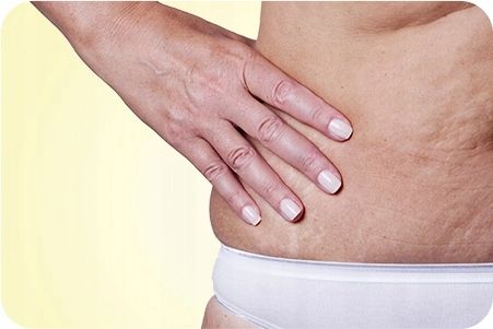 Bio Oil Naturalny, olejek do pielęgnacji skóry, 200 ml na Arena.pl