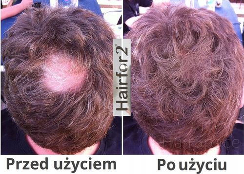 HairFor2 100ml Mikrowłókna w Sprayu do Zagęszczania Włosów na Arena.pl