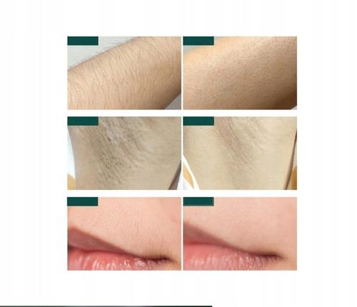 DEPILATOR IPL DO WŁOSÓW CIAŁA LASEROWY BIKINI NÓG DEPILACJA BEZBOLESNY na Arena.pl