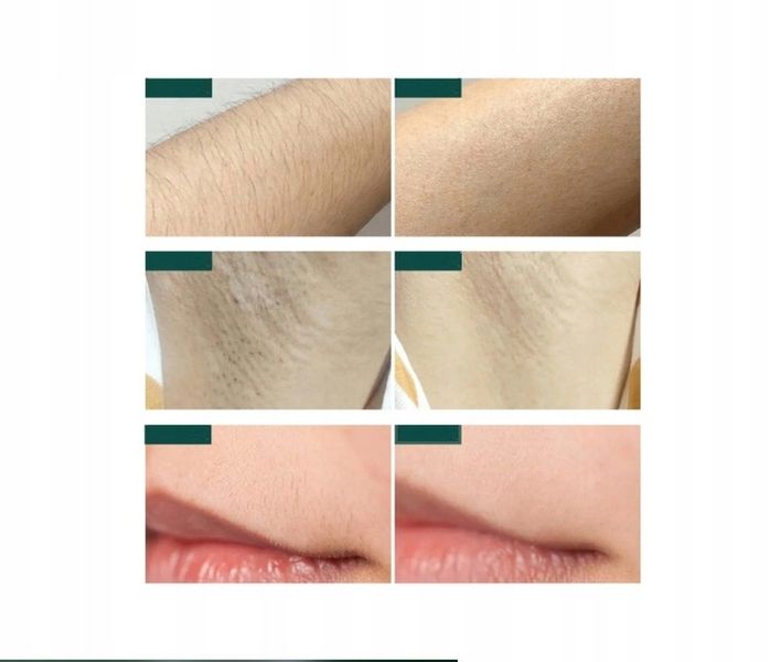 DEPILATOR IPL DO WŁOSÓW CIAŁA LASEROWY BIKINI NÓG DEPILACJA BEZBOLESNY zdjęcie 7