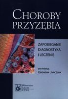 Choroby przyzębia Zapobieganie diagnostyka i