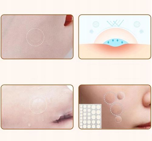 Plaster na Pryszcze trądzik do pryszczy Pimple Patches na Wypryski na Arena.pl