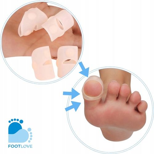 Nakładki silikonowe na wrastający paznokieć N75 na Arena.pl