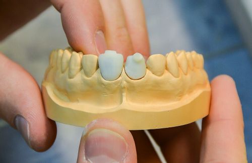 Silikon platinum dla techników dentystycznych 6 kg na Arena.pl