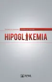 Hipoglikemia