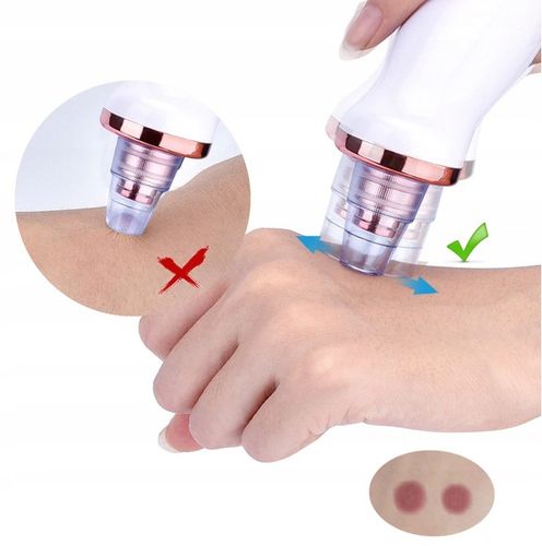 ODKURZACZ WĄGRÓW 12w1 Mikrodermabrazja + Masażer + na Arena.pl