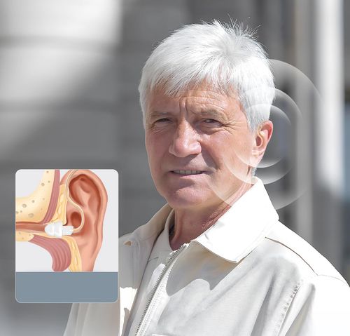 Aparat słuchowy wzmacniacz słuchu Delmicure VHP-1704 regulacja POWYSTAWOWY na Arena.pl