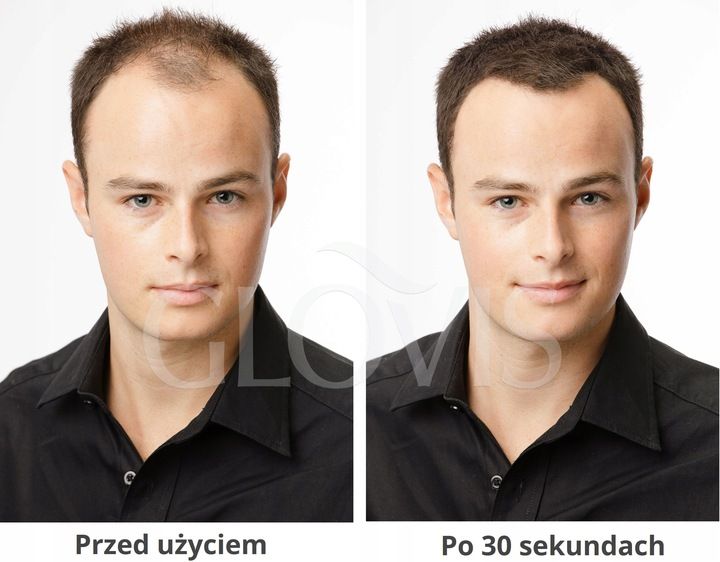 GLOVIS Spray Applicator Dozująca Pompka do Włókien zdjęcie 4