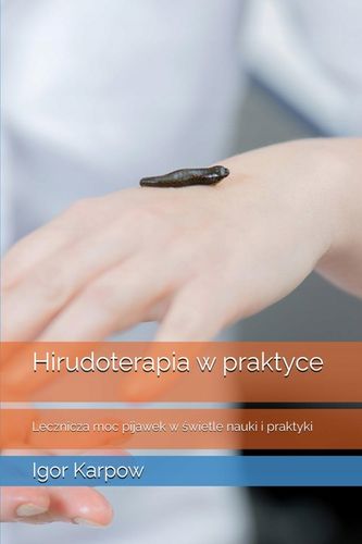 Hirudoterapia w praktyce: Lecznicza moc pijawek w świetle nauki i praktyki na Arena.pl