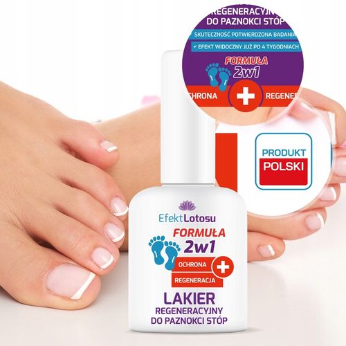 LAKIER PREPARAT NA GRZYBICĘ PAZNOKCI STÓP PRZECIWGRZYBICZNY OCHRONA 3x na Arena.pl