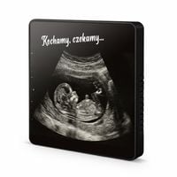 Grający Magnes na Lodówkę z Muzyką i Zdjęciem USG Pamiątka Ciąży