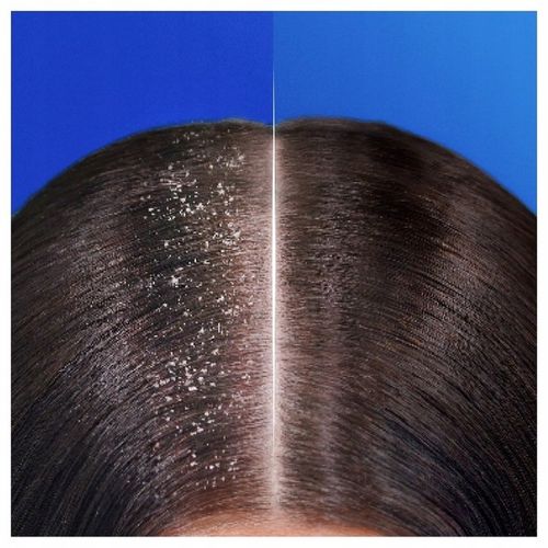 Head & Shoulders Apple Fresh Przeciwłupieżowy szampon do włosów 800ml na Arena.pl