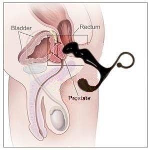 Masażer Prostaty Power Plug Toy Joy zdjęcie 4