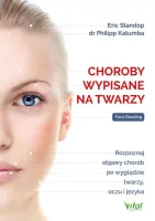 Choroby Wypisane Na Twarzy