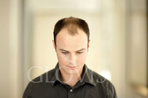 Włókna Mikrowłókna w Sprayu Wodoodporne Zagęszczanie Włosów Naturalny na Arena.pl