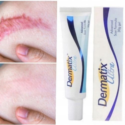 Dermatix żel na blizny 15 g na Arena.pl