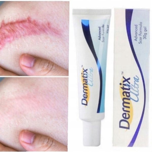 Dermatix żel na blizny 15 g zdjęcie 2