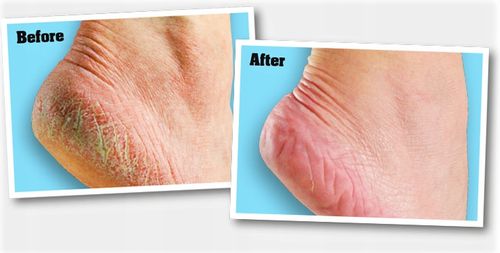 O'keeffe's Healthy Feet 85 Ml Krem Do Stóp na Arena.pl
