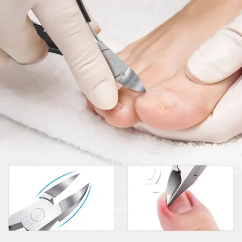 CĄŻKI DO WRASTAJĄCYCH PAZNOKCI CĘGI BESTOPE na Arena.pl