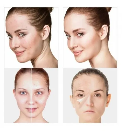 DARSONVAL DERMA WAND DARSONWAL MOCNY 4 PELOTY na Arena.pl