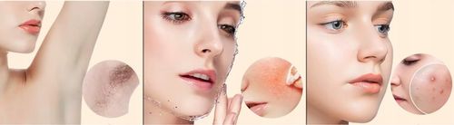 DEPILATOR LASEROWY IPL DO WŁOSÓW TWARZY CIAŁA BIKINI DEPILACJA na Arena.pl