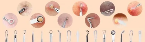 ZESTAW ŁYŻECZKI UNY DO USUWANIA WĄGRÓW ZASKÓRNIKÓW NARZĘDZIA DWUSTRONE ETUI na Arena.pl