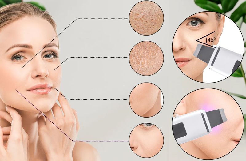 PEELING KAWITACYJNY BEZPRZEWODOWY URZĄDZENIE PILING DO TWARZY 5W1 BIAŁ zdjęcie 11