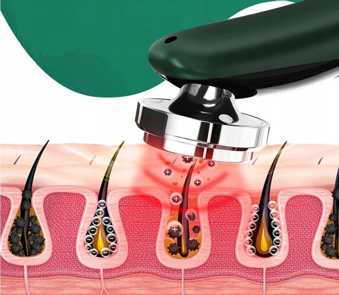 Masażer do twarzy RADIOTERAPIA EMS (E068) zdjęcie 6