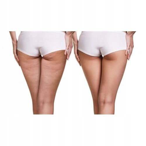 MASAŻER RĘCZNY DO MASAŻU STÓP CELLULIT STOP BÓL zdjęcie 4