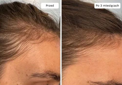 Wcierka Serum na porost i wypadanie włosów wzmacnia cebulki - Lavress 10w1 na Arena.pl