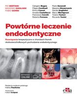 Powtórne leczenie endodontyczne P. Bertani