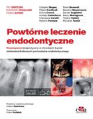 Powtórne leczenie endodontyczne P. Bertani