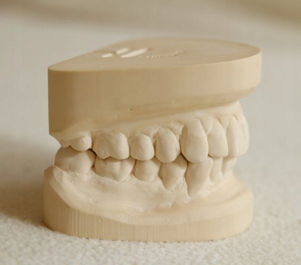 Silikon platinum dla techników dentystycznych 6 kg zdjęcie 2
