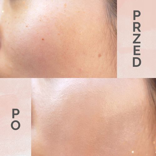 Podkład w kompakcie Dr.HEDISON Miracle Cushion SPF 50+ Natural Beige 2x15g na Arena.pl