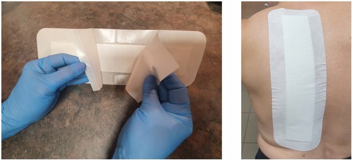 PLASTER Z OPATRUNKIEM STERYLNY NA RANY Z WKŁADEM CHŁONNYM 30x10cm 25szt zdjęcie 13