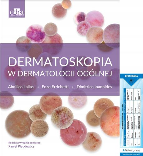 Dermatoskopia w dermatologii ogólnej na Arena.pl