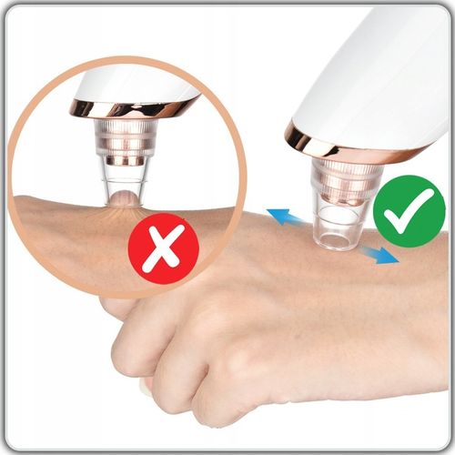 ELEKTRYCZNY PRZYRZĄD ODKURZACZ DO WĄGRÓW PRYSZCZY ZASKÓRNIKÓW 15w1 na Arena.pl