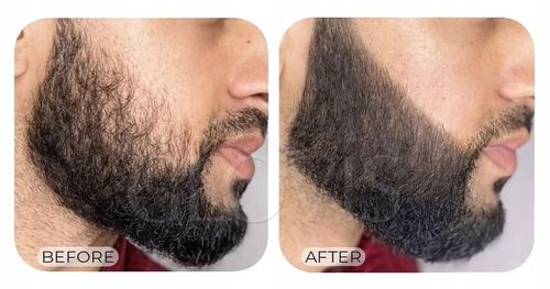 GLOVIS FILLER Zestaw do Wypełniania Zarostu Brody Marker Pisak + na Arena.pl