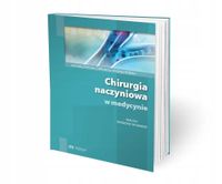 Chirurgia naczyniowa w medycynie