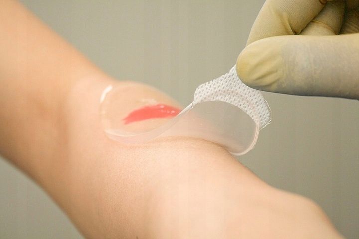 OPATRUNEK HYDROŻELOWY na oparzenia RATUNKOWY Kikgel BurnTec 12cmx12 cm 1szt zdjęcie 5