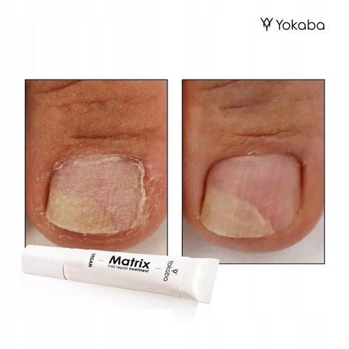Yokaba Matrix Nail Repair Treatment Preparat do regeneracji paznokci 15ml na Arena.pl