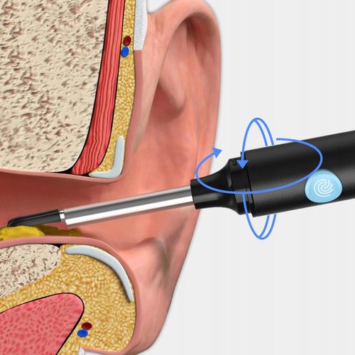 SMART OTOSKOP Z KAMERKĄ WIFI DO CZYSZCZENIA USZU NARZĘDZIA ZESTAW ENDOSKOP na Arena.pl