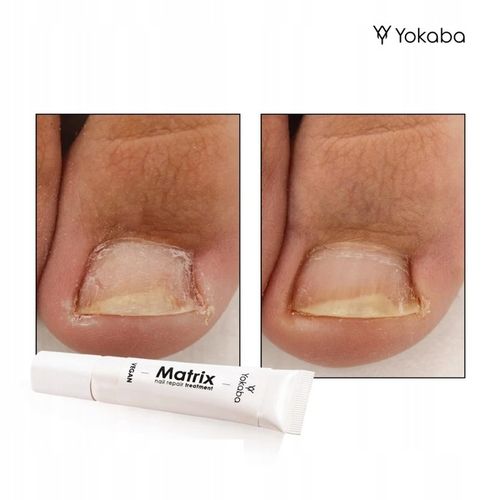 Yokaba Matrix Nail Repair Treatment Preparat do regeneracji paznokci 15ml na Arena.pl