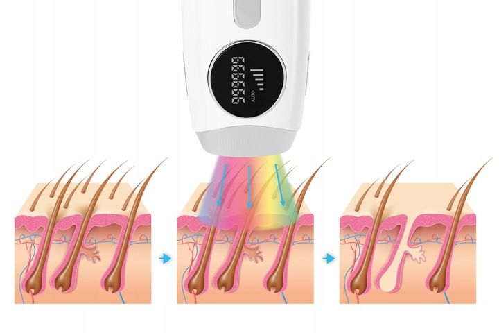 Depilator IPL Krexus Ciało Bikini PRO 5 trybów zdjęcie 8